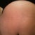 No stretch marks at the top of my stomach Wk6