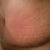 Very swollen Wk6 TT