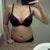 post op day 45 :  wearing a 36c bra