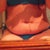 Before, sitting, lots of sagging skin. 