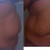 Side and Front Before shots