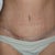 5 weeks.Tummy