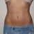 11 weeks post zeltiq