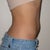 11 weeks post zeltiq