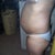 The day before surgery 