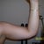 The day before surgery