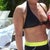 abdomen 16 months after surgery