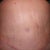 front view of my new tummy