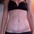 Pic of scar. Nice and flat. Still a little red