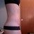 Side profile. As you can see..a little swollen at bottom of tummy, but it still looks good!!