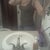 Days before surgery