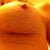 Incision 1 week post surgery and nipple off to the side a little from swelling