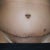 PO Day 7 - ONE WEEK!!!!!!!!
