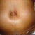 Close up of new belly button on day 2