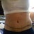 3weeks post-op