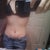 Before surgery.  You can't really even see how much skin there was but it was over 3lbs total.