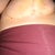 Right underside 2 wks