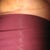 Left underside 2 wks