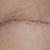 05/03/13-PO 4 WEEKS left side