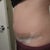 swelling at the end of the same day, just bloated looking