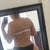 7 weeks post-op.