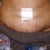 1 day op