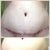 Top scar was 1 month ago - bottom from today....I think it's looking good!