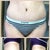 Scar is nice & low, covered by small panties...YAY! 
I know, I know...legs & butt still needs LOTS of work, I'm workin' on it!!!