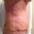 2 weeks po side view