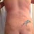 2 weeks back is swollen...I hope that is not dimpling I see.