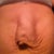 I have major abdominal seperation.  My intestines bulge out when I lean back.
