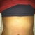 4 days post op