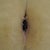 Belly Button healing slowly