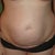 Tummy Before
