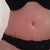 With same style knickers I was marked in originally! 4 weeks PO