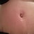Up close belly button - 4 weeks PO