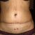 Two weeks after