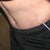 This is three weeks Post op