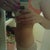 7 weeks post op
