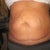Before frontal view