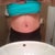 6dpo front