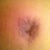 My belly button