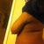pics from Dec 2011.  What the girls look like prior to surgery