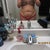 before pic. The night before my surgery.