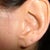 Before Left Ear