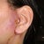 Left ear after surgery