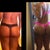 Right b4 BBL and 1-week post op.