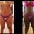 My hips look uneven. The left hip looks very similar to the one in my b4 pic. I told him not to make me look wide but damn...I'm pissed but trying to stay positive.