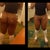 3 days post op--another view of hips
