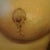 3wks PO Righty